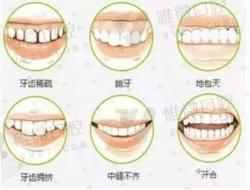 德国bego种植牙（bego是哪个很多国家的）(图1)